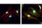 Acetyl Lysine antibody, 9441L, Cell Signaling Technology, Immunofluorescence image 