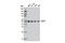 Dihydrolipoamide S-Succinyltransferase antibody, 11954S, Cell Signaling Technology, Western Blot image 