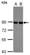 Protein Kinase C Substrate 80K-H antibody, PA5-27551, Invitrogen Antibodies, Western Blot image 