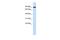 Glucose 1,6-bisphosphate synthase antibody, PA5-44390, Invitrogen Antibodies, Western Blot image 