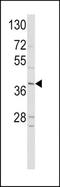Neurogenic differentiation factor 1 antibody, TA324696, Origene, Western Blot image 