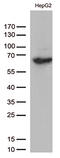 SLU7 Homolog, Splicing Factor antibody, M07557, Boster Biological Technology, Western Blot image 
