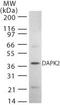 Death Associated Protein Kinase 2 antibody, PA1-41305, Invitrogen Antibodies, Western Blot image 