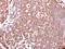 Mucin 4, Cell Surface Associated antibody, GTX100775, GeneTex, Immunohistochemistry paraffin image 
