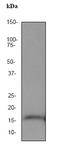 Microtubule Associated Protein 1 Light Chain 3 Alpha antibody, ab52768, Abcam, Western Blot image 