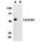 C-X3-C Motif Chemokine Receptor 1 antibody, AHP566, Bio-Rad (formerly AbD Serotec) , Flow Cytometry image 