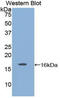 Glial Cell Derived Neurotrophic Factor antibody, LS-C294195, Lifespan Biosciences, Western Blot image 