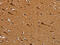 NADH:Ubiquinone Oxidoreductase Subunit S5 antibody, CSB-PA064548, Cusabio, Immunohistochemistry paraffin image 