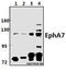 EPH Receptor A7 antibody, A03943, Boster Biological Technology, Western Blot image 