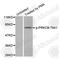 Protein Kinase C Beta antibody, AP0191, ABclonal Technology, Western Blot image 