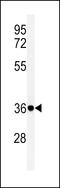 Fc Fragment Of IgG Receptor Ia antibody, 61-719, ProSci, Western Blot image 