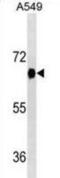 Dual Specificity Tyrosine Phosphorylation Regulated Kinase 2 antibody, abx025430, Abbexa, Western Blot image 