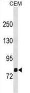 Olfactomedin Like 2B antibody, abx031184, Abbexa, Western Blot image 