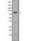 Leucine Rich Repeat And Sterile Alpha Motif Containing 1 antibody, abx216616, Abbexa, Western Blot image 