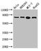 RTF1 Homolog, Paf1/RNA Polymerase II Complex Component antibody, LS-C679376, Lifespan Biosciences, Western Blot image 