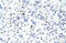 Heterogeneous Nuclear Ribonucleoprotein L antibody, 29-230, ProSci, Immunohistochemistry paraffin image 