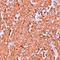 Zinc Finger And BTB Domain Containing 8A antibody, orb75553, Biorbyt, Immunohistochemistry paraffin image 
