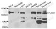 Procollagen-Lysine,2-Oxoglutarate 5-Dioxygenase 1 antibody, A7919, ABclonal Technology, Western Blot image 
