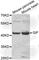 Cobalamin Binding Intrinsic Factor antibody, A6914, ABclonal Technology, Western Blot image 