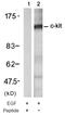 KIT antibody, AP08062PU-N, Origene, Western Blot image 