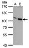 Vav Guanine Nucleotide Exchange Factor 1 antibody, NBP2-43553, Novus Biologicals, Western Blot image 