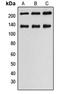Myosin Light Chain Kinase antibody, GTX55159, GeneTex, Western Blot image 