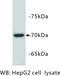 Alpha Fetoprotein antibody, MBS355144, MyBioSource, Western Blot image 