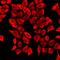 Retinoic Acid Receptor Alpha antibody, LS-C667974, Lifespan Biosciences, Immunofluorescence image 