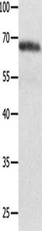 NADPH Oxidase 4 antibody, CSB-PA777165, Cusabio, Western Blot image 