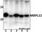 Mitochondrial Ribosomal Protein L22 antibody, GTX66814, GeneTex, Western Blot image 