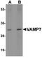 Vesicle Associated Membrane Protein 7 antibody, NBP2-41183, Novus Biologicals, Western Blot image 
