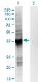 GIPC PDZ Domain Containing Family Member 2 antibody, H00054810-M02, Novus Biologicals, Western Blot image 