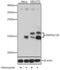 Microtubule Associated Protein 1 Light Chain 3 Beta antibody, A11282, ABclonal Technology, Western Blot image 