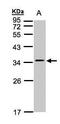 Calcium Voltage-Gated Channel Auxiliary Subunit Gamma 5 antibody, PA5-21508, Invitrogen Antibodies, Western Blot image 