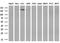 Transient Receptor Potential Cation Channel Subfamily M Member 4 antibody, GTX83490, GeneTex, Western Blot image 