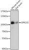 G Protein-Coupled Receptor 155 antibody, 16-477, ProSci, Western Blot image 