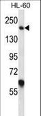 Myomesin 1 antibody, LS-C164726, Lifespan Biosciences, Western Blot image 