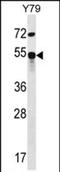 Zinc Finger Protein 14 antibody, PA5-71654, Invitrogen Antibodies, Western Blot image 