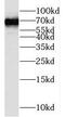 Protein Tyrosine Phosphatase Non-Receptor Type 9 antibody, FNab06941, FineTest, Western Blot image 