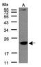 Transmembrane Protein 147 antibody, orb74225, Biorbyt, Western Blot image 