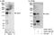 AP2 Associated Kinase 1 antibody, A302-146A, Bethyl Labs, Immunoprecipitation image 