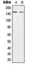 HECT, C2 And WW Domain Containing E3 Ubiquitin Protein Ligase 2 antibody, LS-B16055, Lifespan Biosciences, Western Blot image 