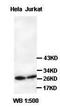 Protein-L-Isoaspartate (D-Aspartate) O-Methyltransferase antibody, orb77173, Biorbyt, Western Blot image 