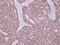 Hexokinase 1 antibody, PA5-28217, Invitrogen Antibodies, Immunohistochemistry paraffin image 