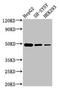 Farnesyl-Diphosphate Farnesyltransferase 1 antibody, LS-B15234, Lifespan Biosciences, Western Blot image 