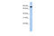 Checkpoint with forkhead and RING finger domains protein antibody, 25-840, ProSci, Enzyme Linked Immunosorbent Assay image 