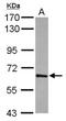 T-Box 21 antibody, NBP2-20583, Novus Biologicals, Western Blot image 