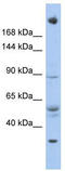 Chromodomain Helicase DNA Binding Protein 4 antibody, TA335875, Origene, Western Blot image 
