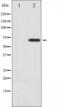 Neurofibromin 2 antibody, abx012075, Abbexa, Western Blot image 