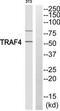 TNF Receptor Associated Factor 4 antibody, TA312962, Origene, Western Blot image 